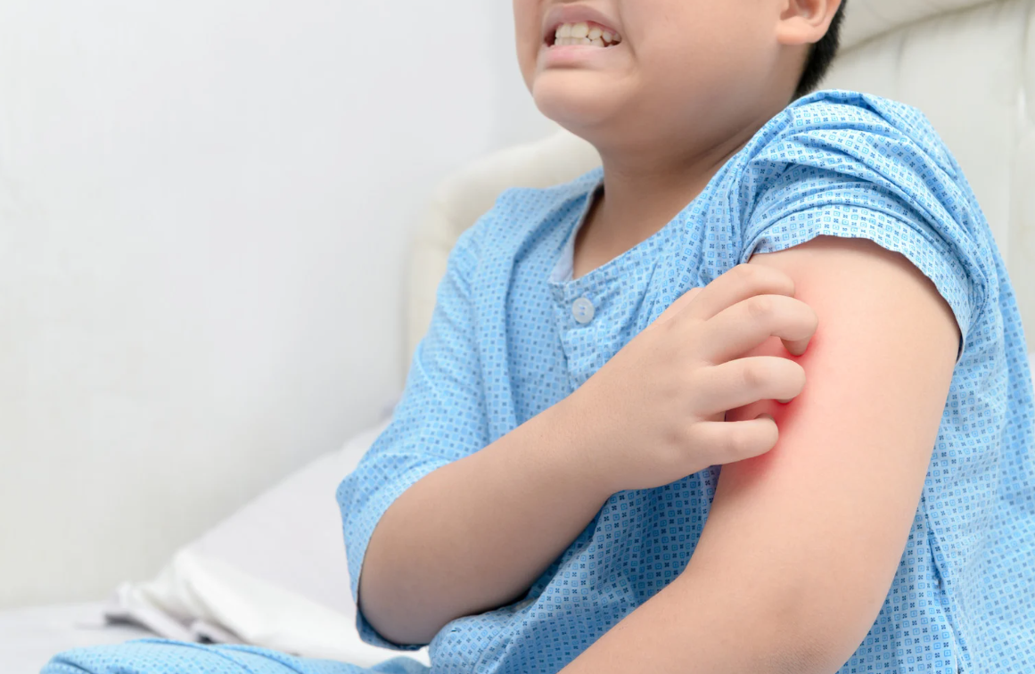 vac-xin-nhay-cam-voi-nhiet-do-cao-anh-huong-va-nguy-co 3.png