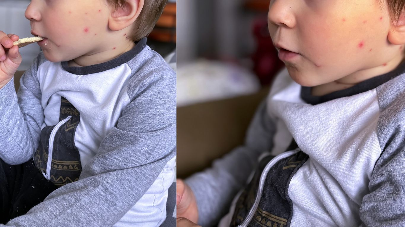 vac-xin-thuy-dau-gia-bao-nhieu 2