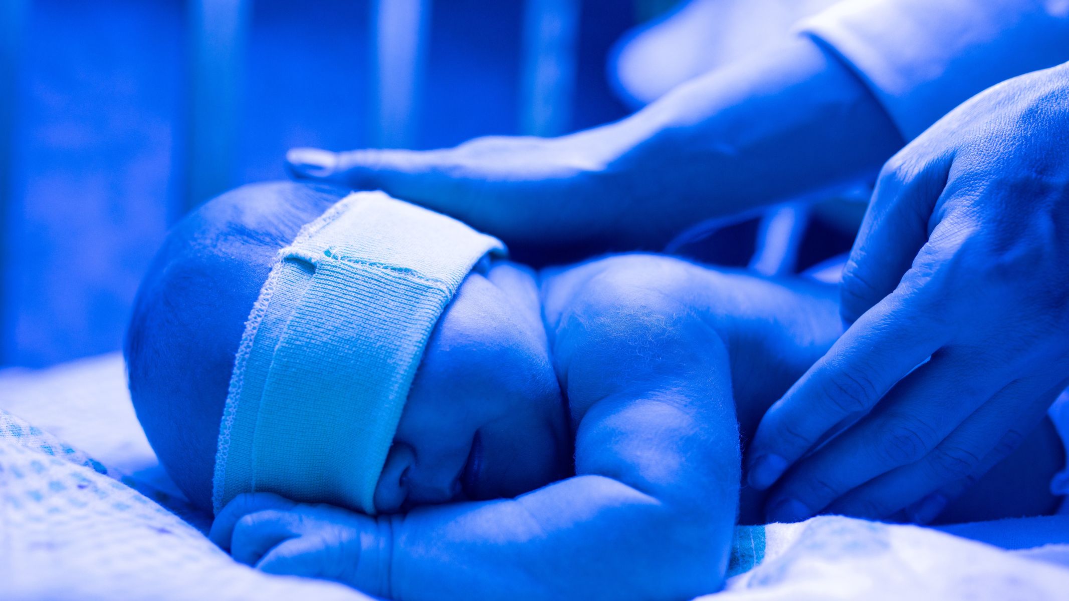 Liệu pháp ánh sáng (chiếu đèn) là phương pháp điều trị nền tảng, giúp chuyển bilirubin tự do thành dạng dễ đào thải qua phân và nước tiểu