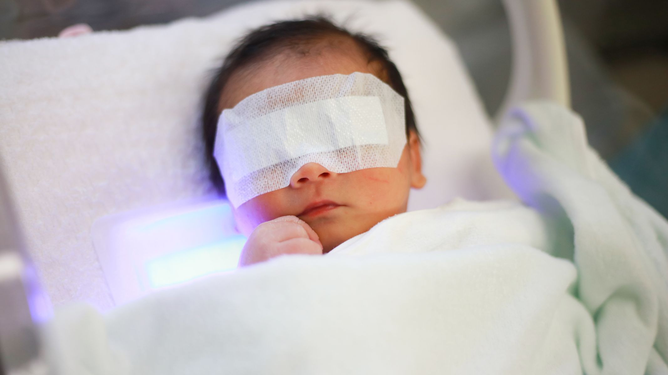 Khi phát hiện trẻ có biểu hiện vàng da ở da hoặc củng mạc mắt, đặc biệt xuất hiện sớm trong 24 giờ đầu sau sinh, cha mẹ cần đưa trẻ đi khám chuyên khoa