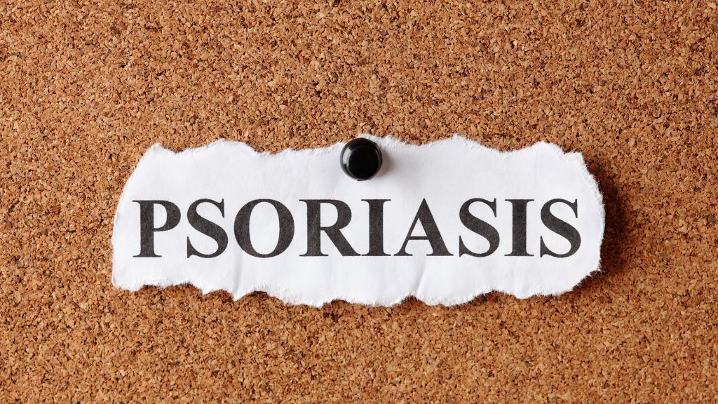 Vảy nến được xếp vào nhóm bệnh tự miễn