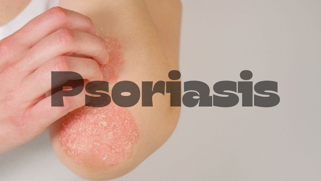 Biểu hiện của vảy nến toàn thân có thể khác nhau tùy từng người