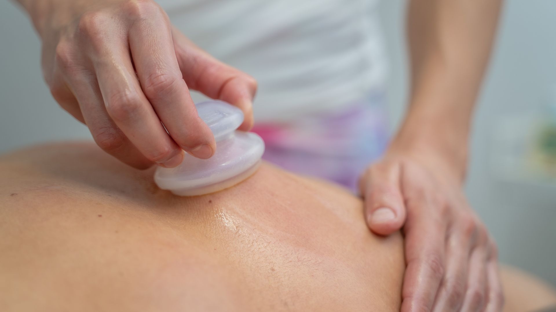 Chườm ấm nhẹ và giữ da sạch giúp vết bầm nhanh mờ, da phục hồi tốt hơn sau giác hơi