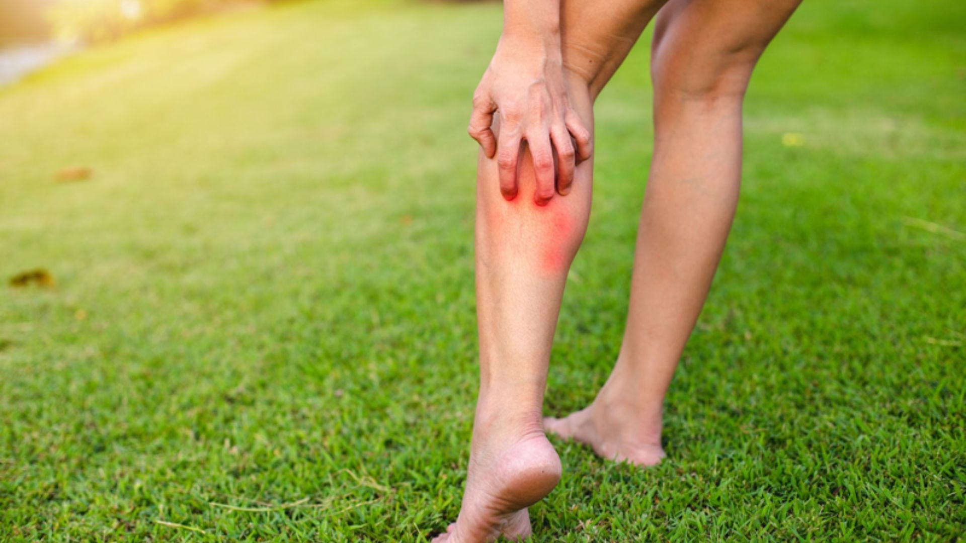 Vết côn trùng cắn sưng đỏ ngứa có sao không là nỗi băn khoăn của nhiều độc giả