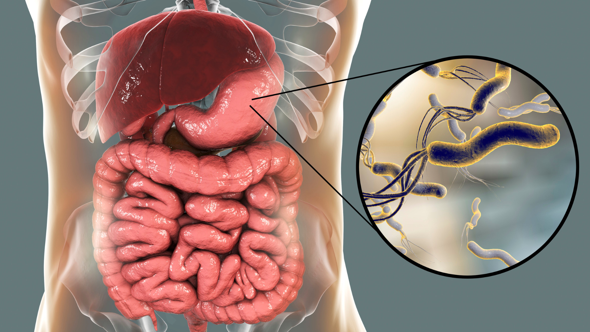 Vi khuẩn HP có nguy hiểm không? Cách điều trị diệt vi khuẩn HP 1