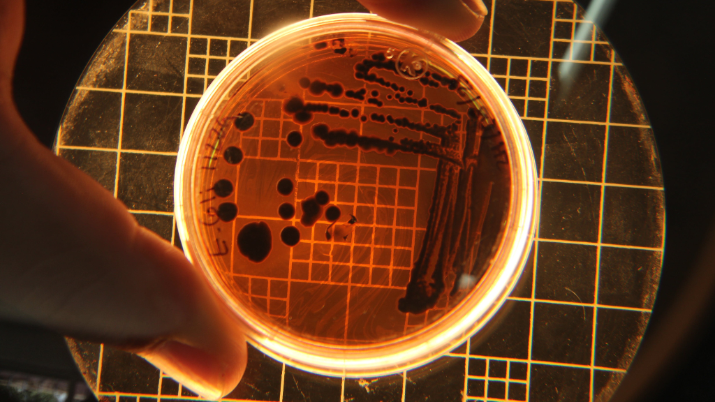 Nhiều loài vi khuẩn kỵ khí có khả năng tiết ngoại độc tố mạnh