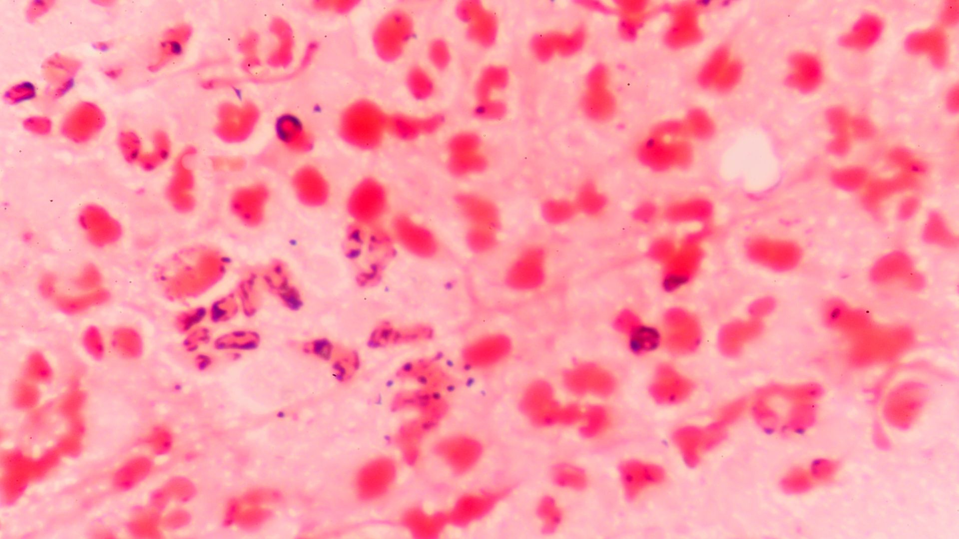 Vi khuẩn lậu (Neisseria gonorrhoeae) là tác nhân gây bệnh lây truyền qua đường tình dục