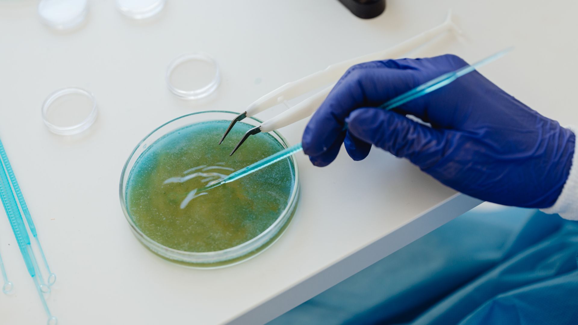 Vi khuẩn nhuộm soi là gì