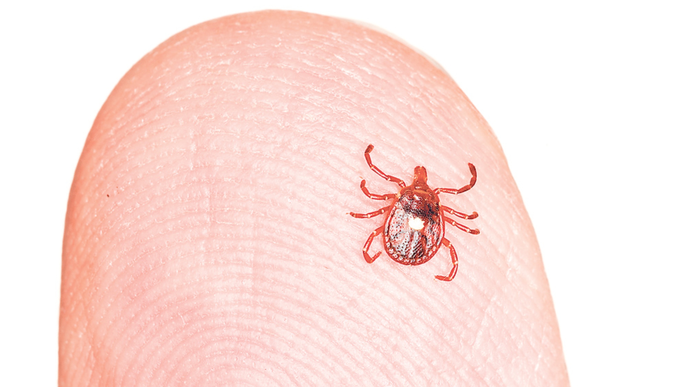 Bệnh sốt mò là một bệnh truyền nhiễm cấp tính do vi khuẩn Orientia tsutsugamushi thuộc nhóm Rickettsia gây ra