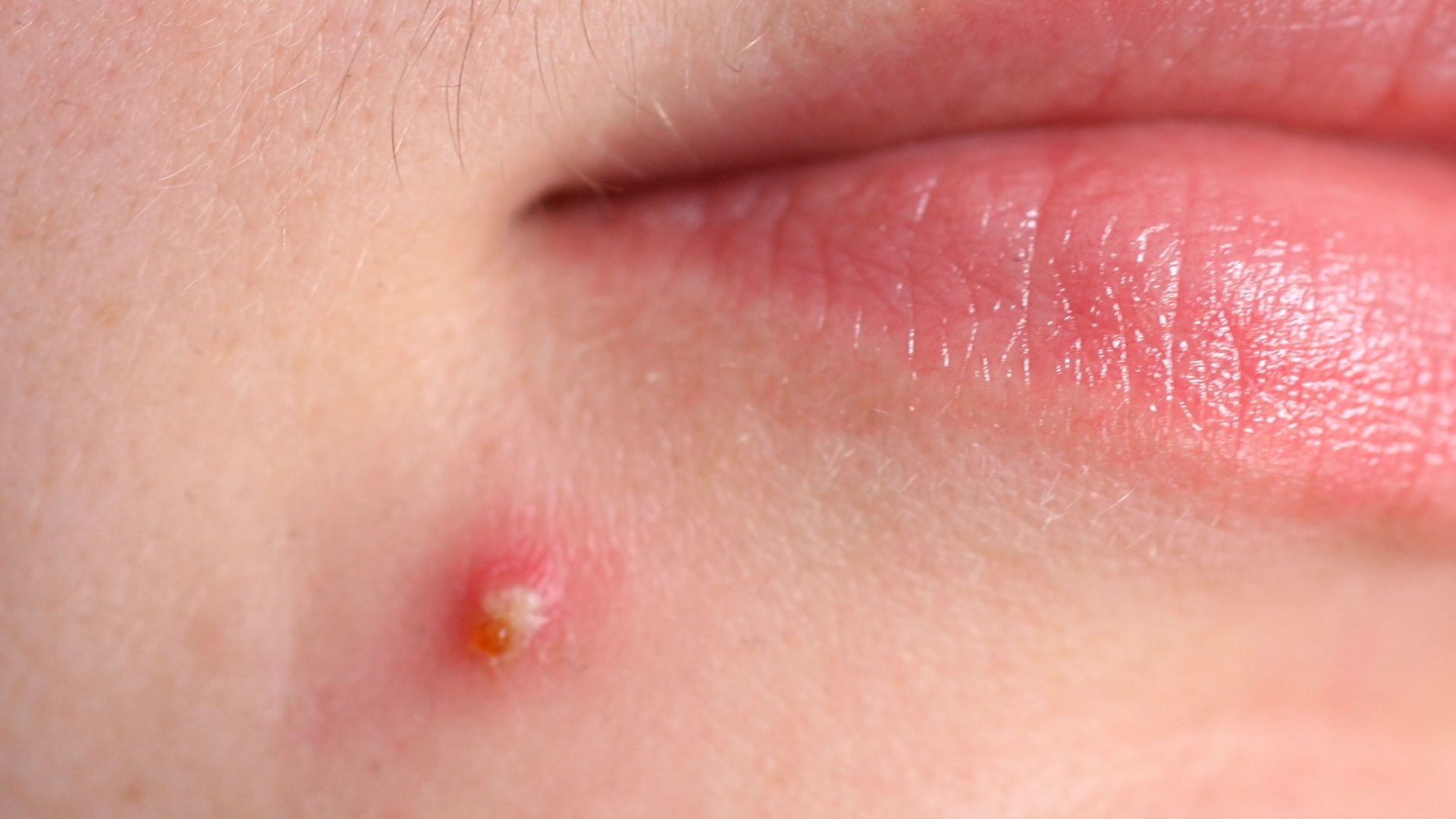 vi-khuan-tu-cau-vang-la-gi-va-no-anh-huong-den-co-the-nhu-the-nao 2.jpg