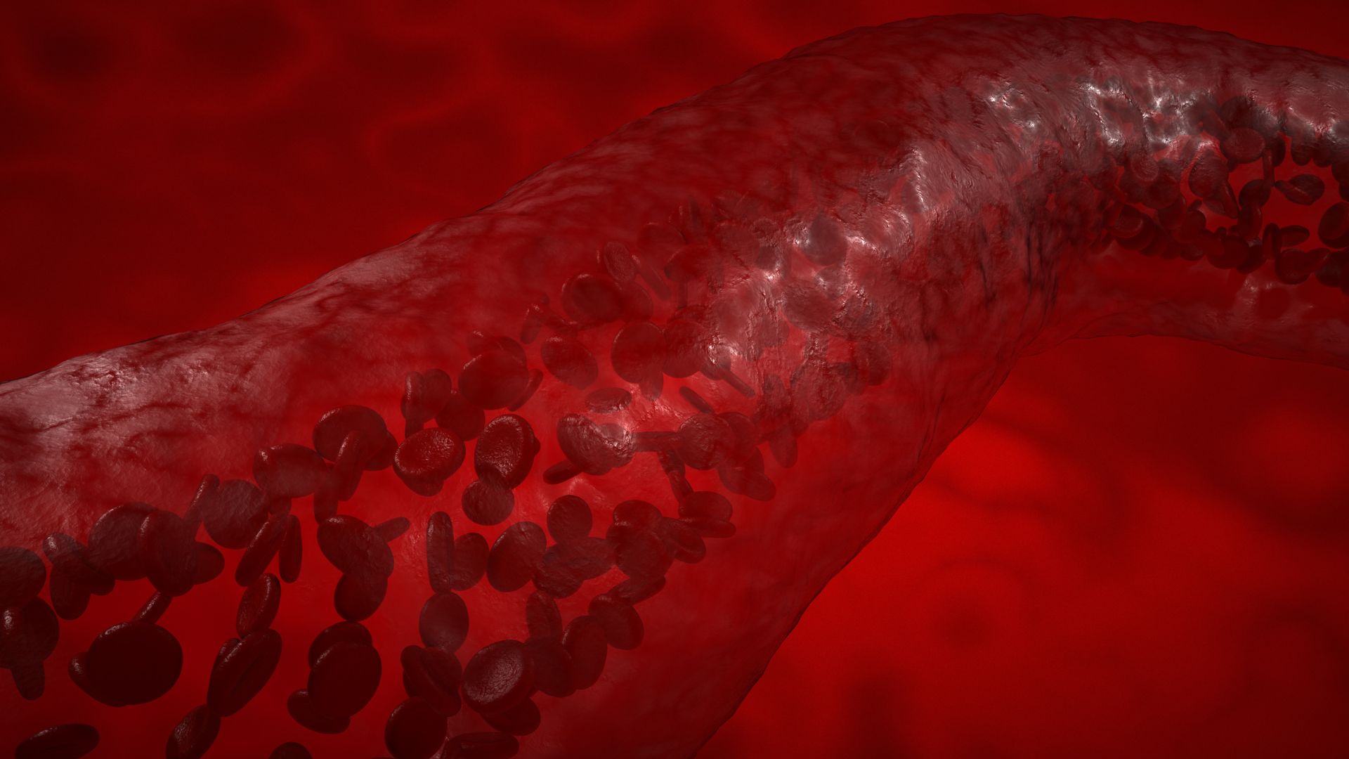 Vì sao ăn mặn tăng huyết áp? Nguy cơ và cách phòng ngừa hiệu quả 2