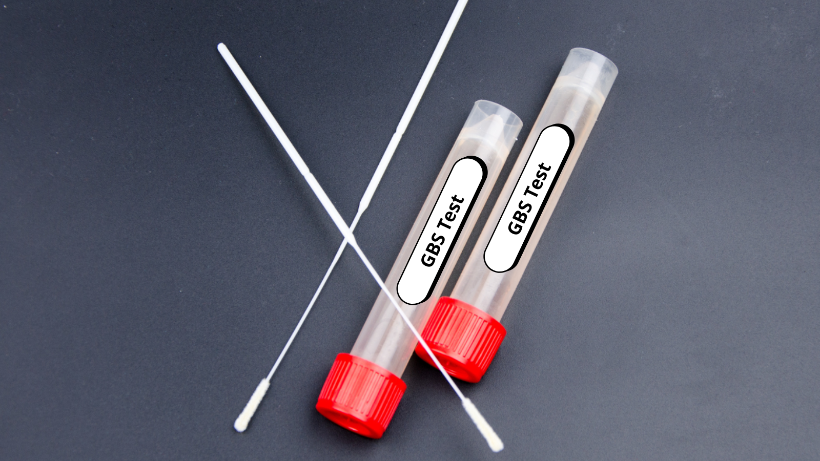 Thai phụ có kết quả dương tính với xét nghiệm GBS là tình trạng khá phổ biến