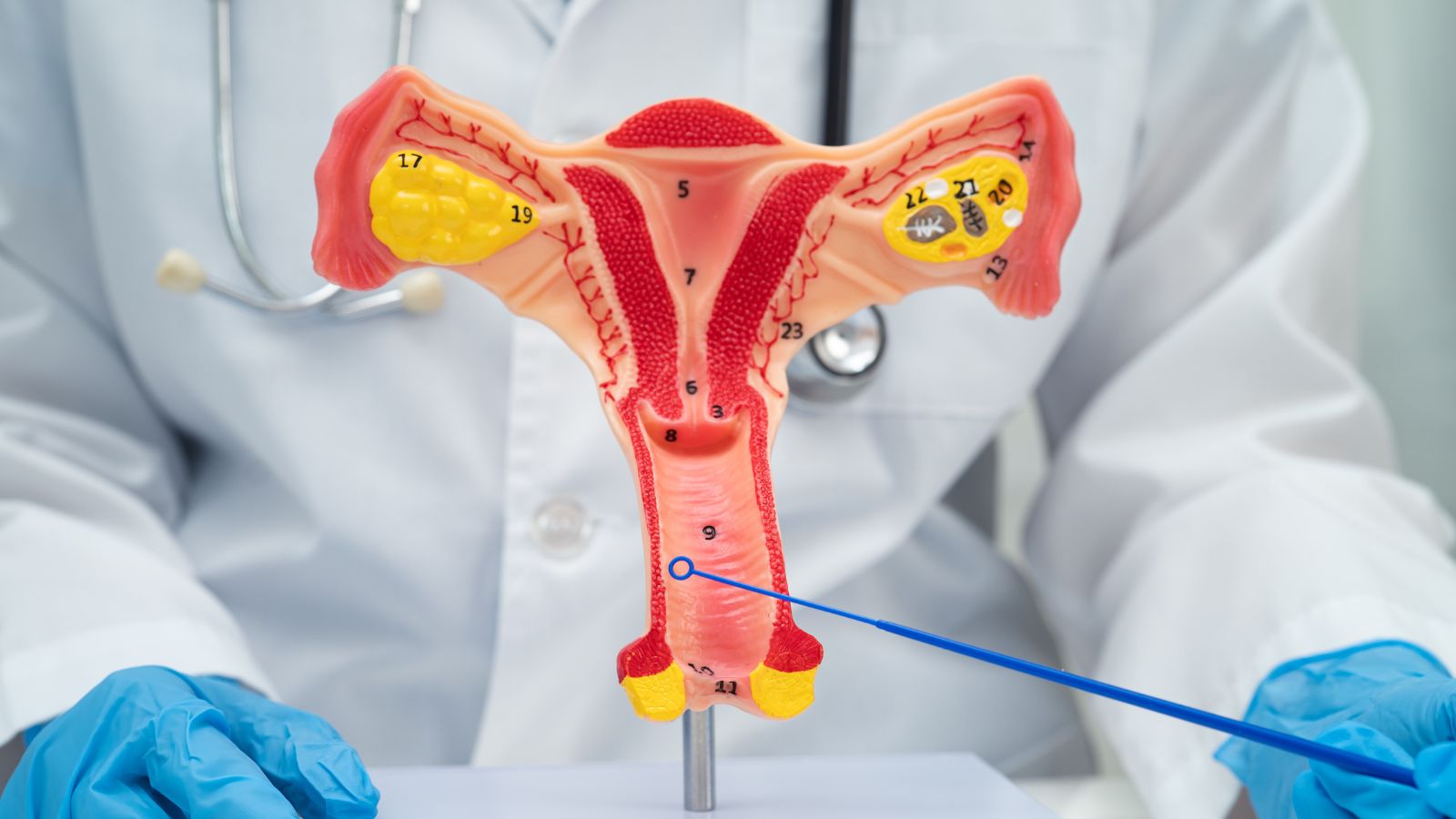 Viêm âm đạo cấp là tình trạng vùng kín bị kích ứng và viêm nhiễm đột ngột