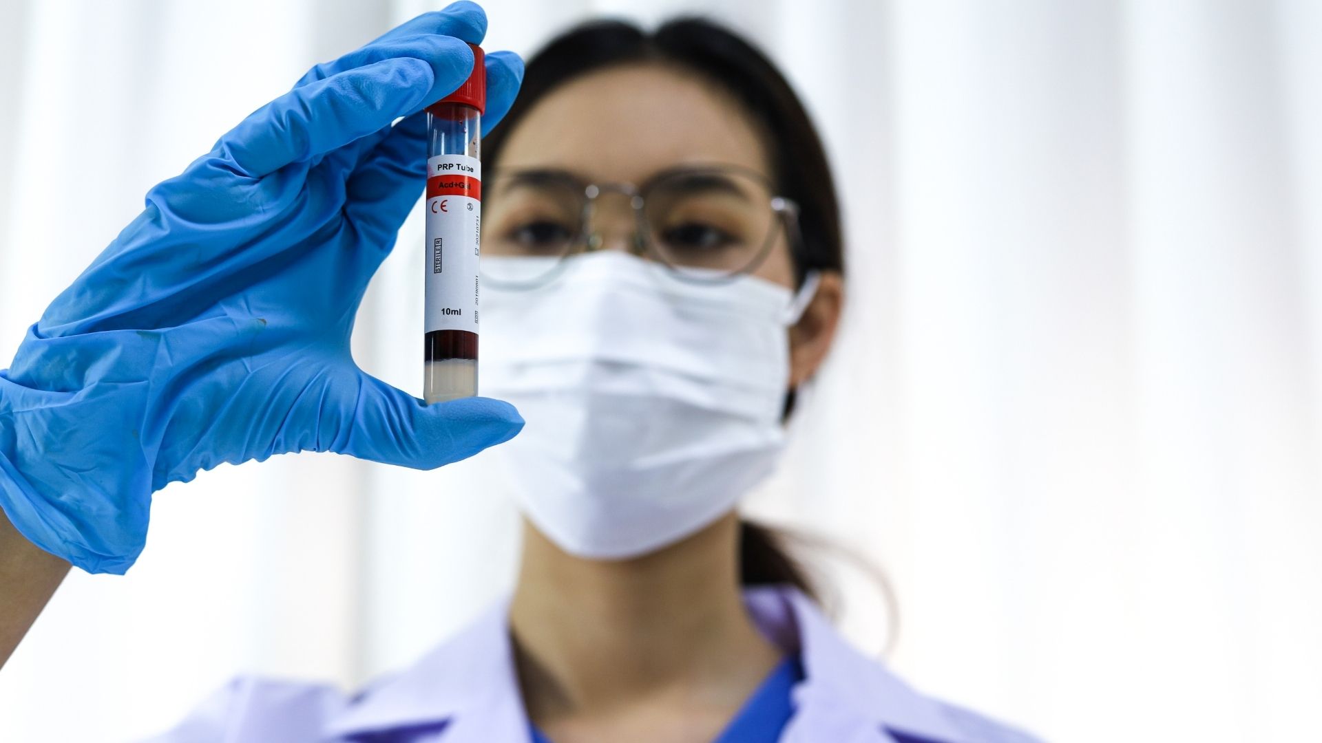 Nhiễm trùng kéo dài gây viêm amidan hốc mủ