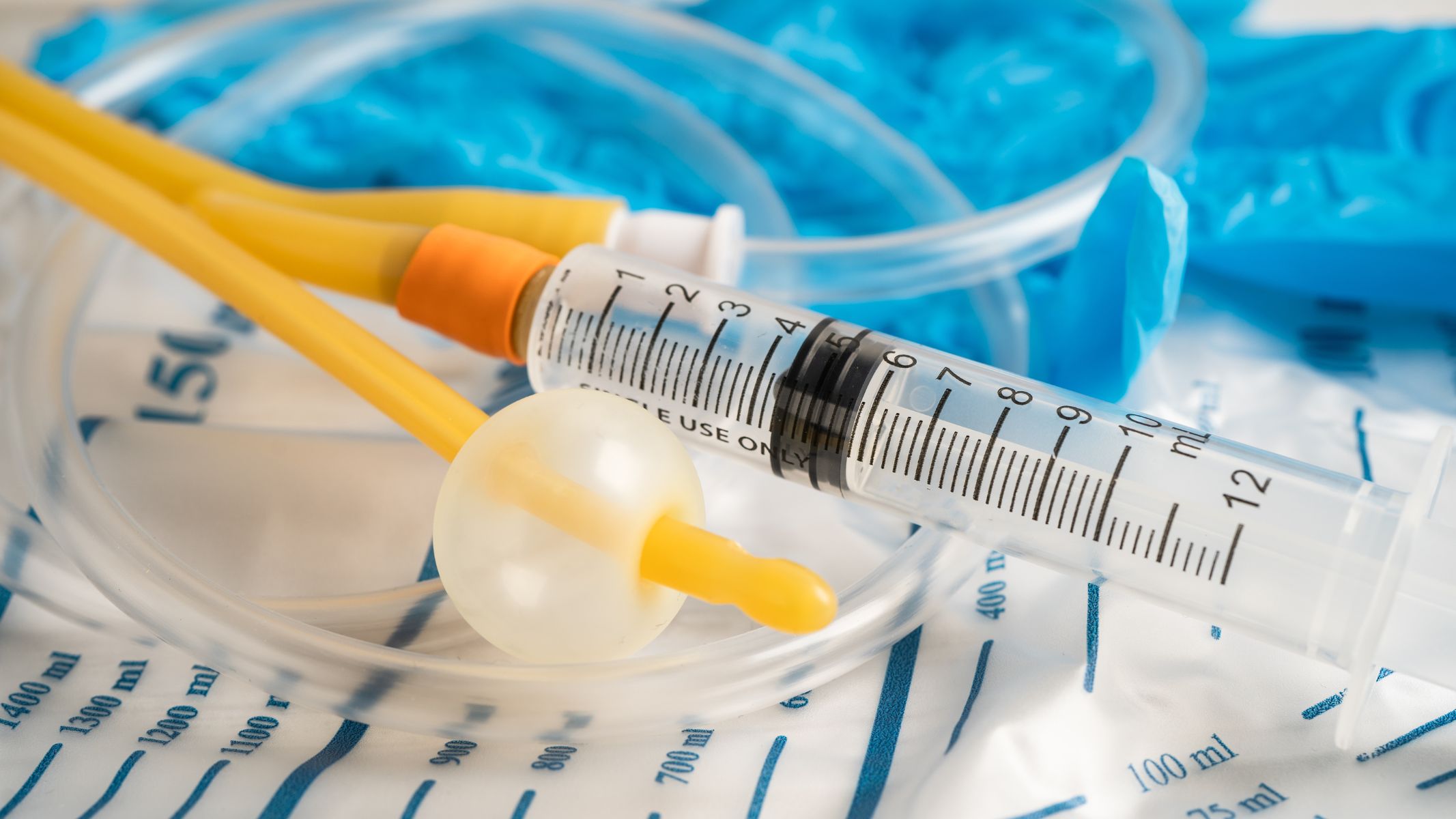 Viêm bàng quang có tự khỏi không? Những thông tin cần biết 2