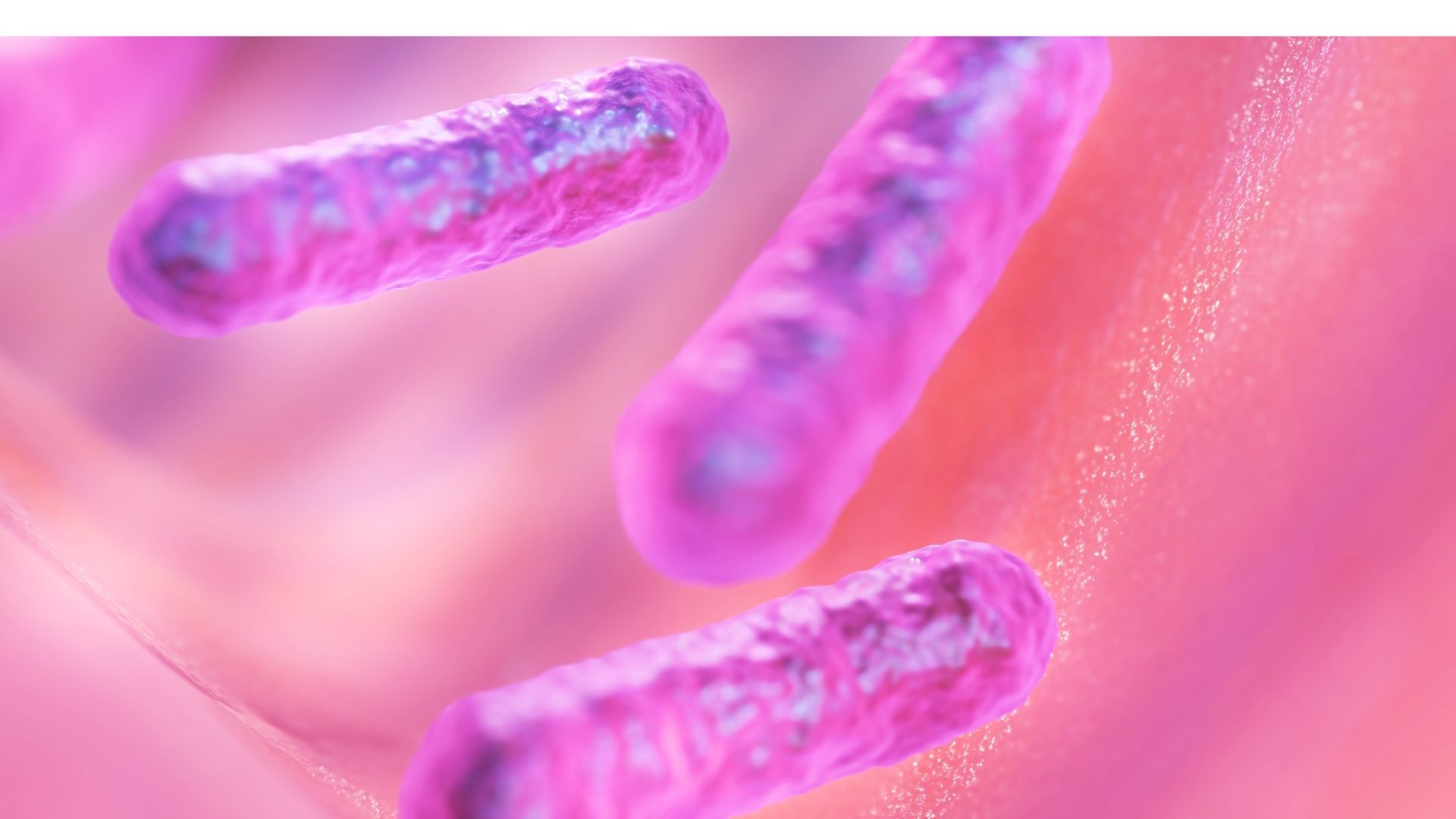 Nguyên nhân gây viêm bao quy đầu thường là vi khuẩn