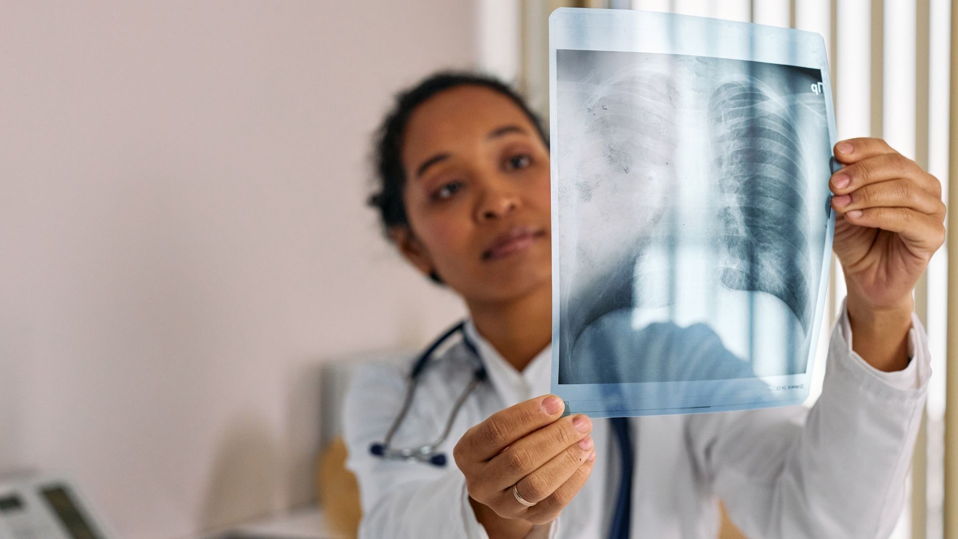 Viêm bì cơ có thể gây biến chứng trên nhiều hệ cơ quan