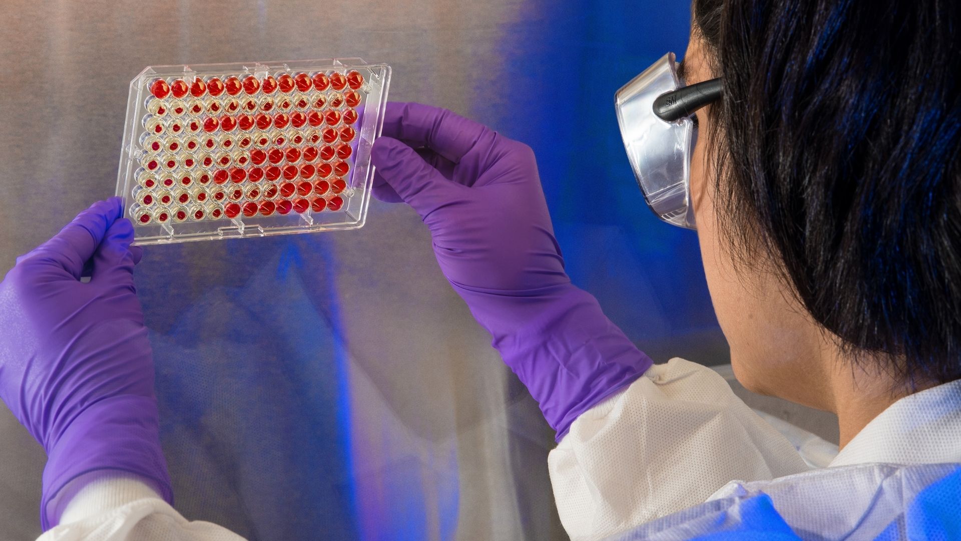 Nguyên nhân gây viêm bì cơ có thể do rối loạn miễn dịch