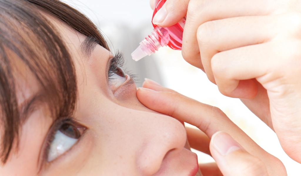 Dị ứng mỹ phẩm hoặc thuốc nhỏ mắt có thể gây sưng đỏ, kích ứng và viêm mí mắt