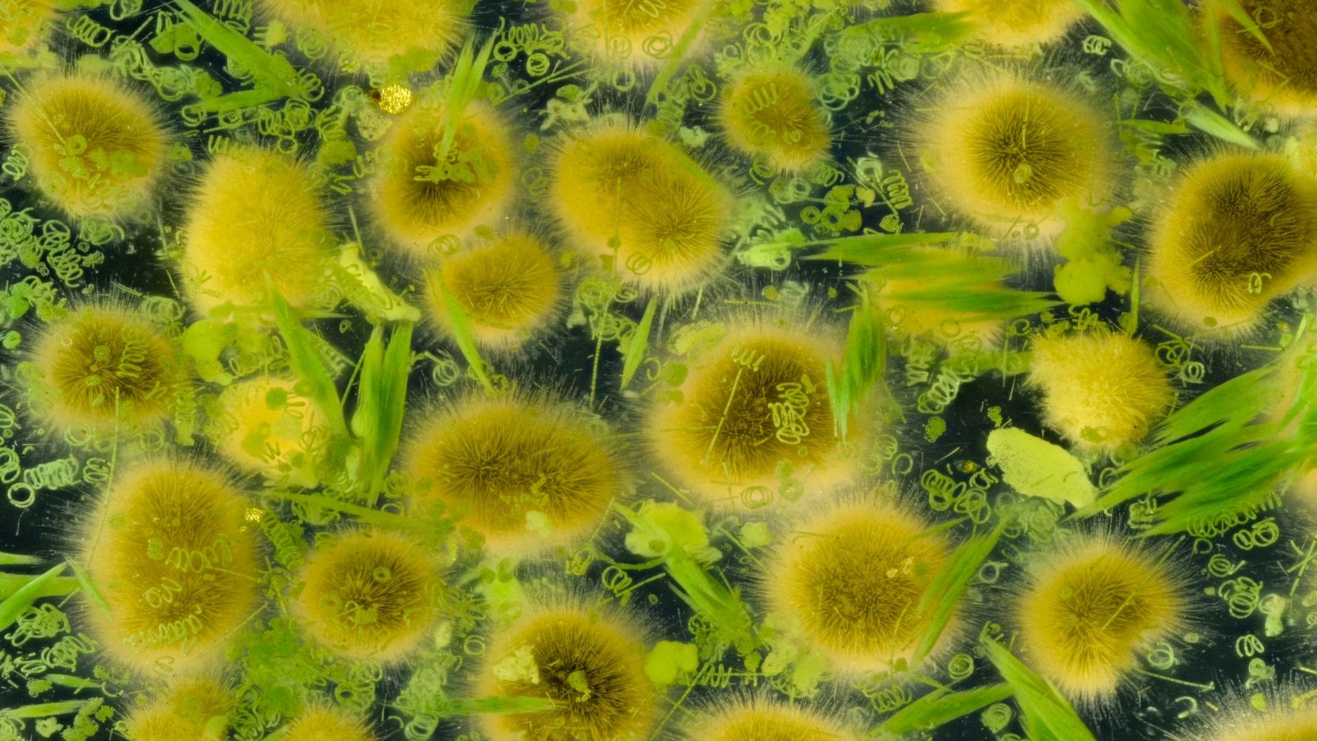 Viêm bờ mi có thể gây ra do tụ cầu vàng