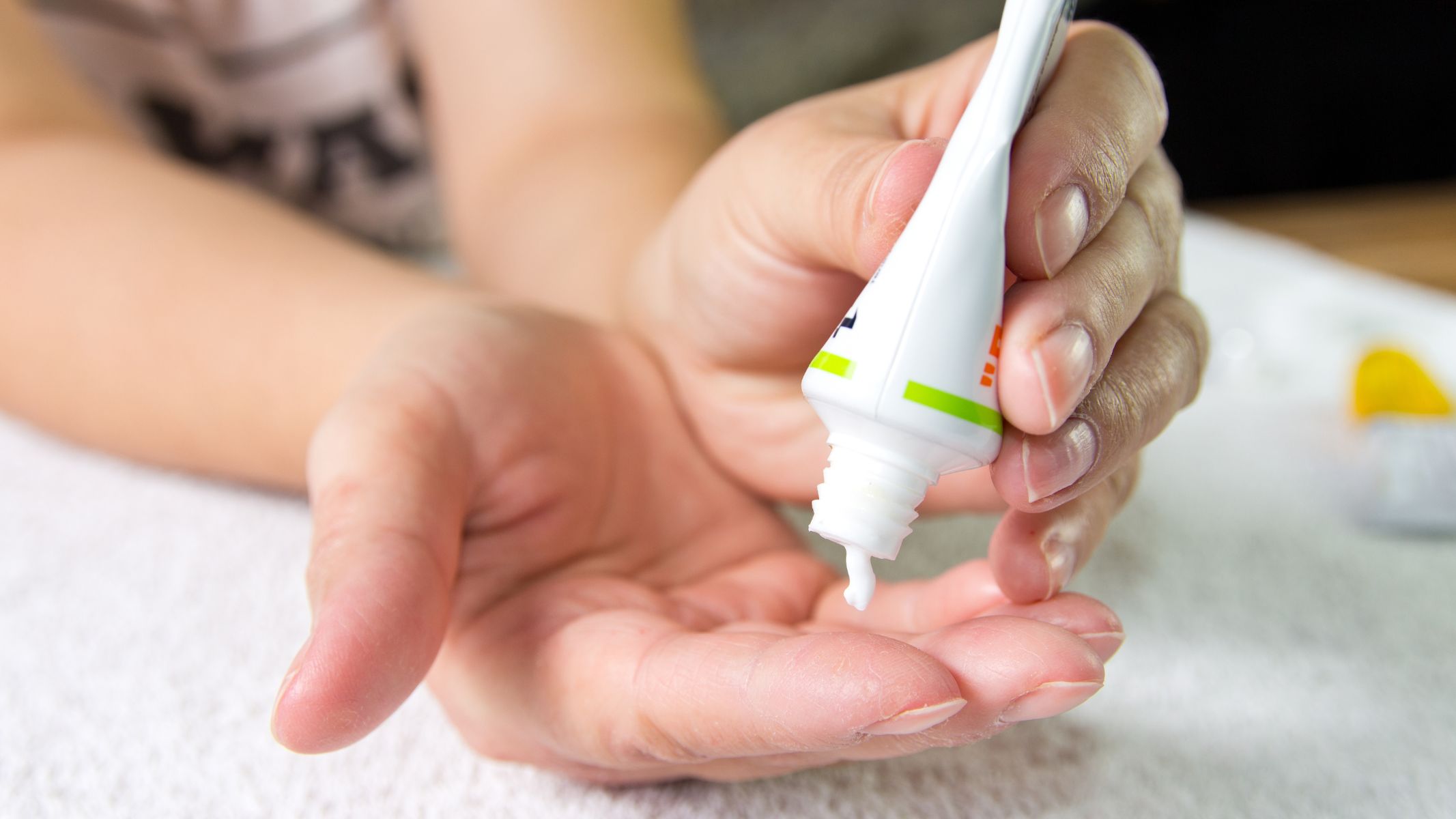 Corticosteroid dạng bôi giúp làm dịu phản ứng viêm, giảm sưng đỏ và ngứa