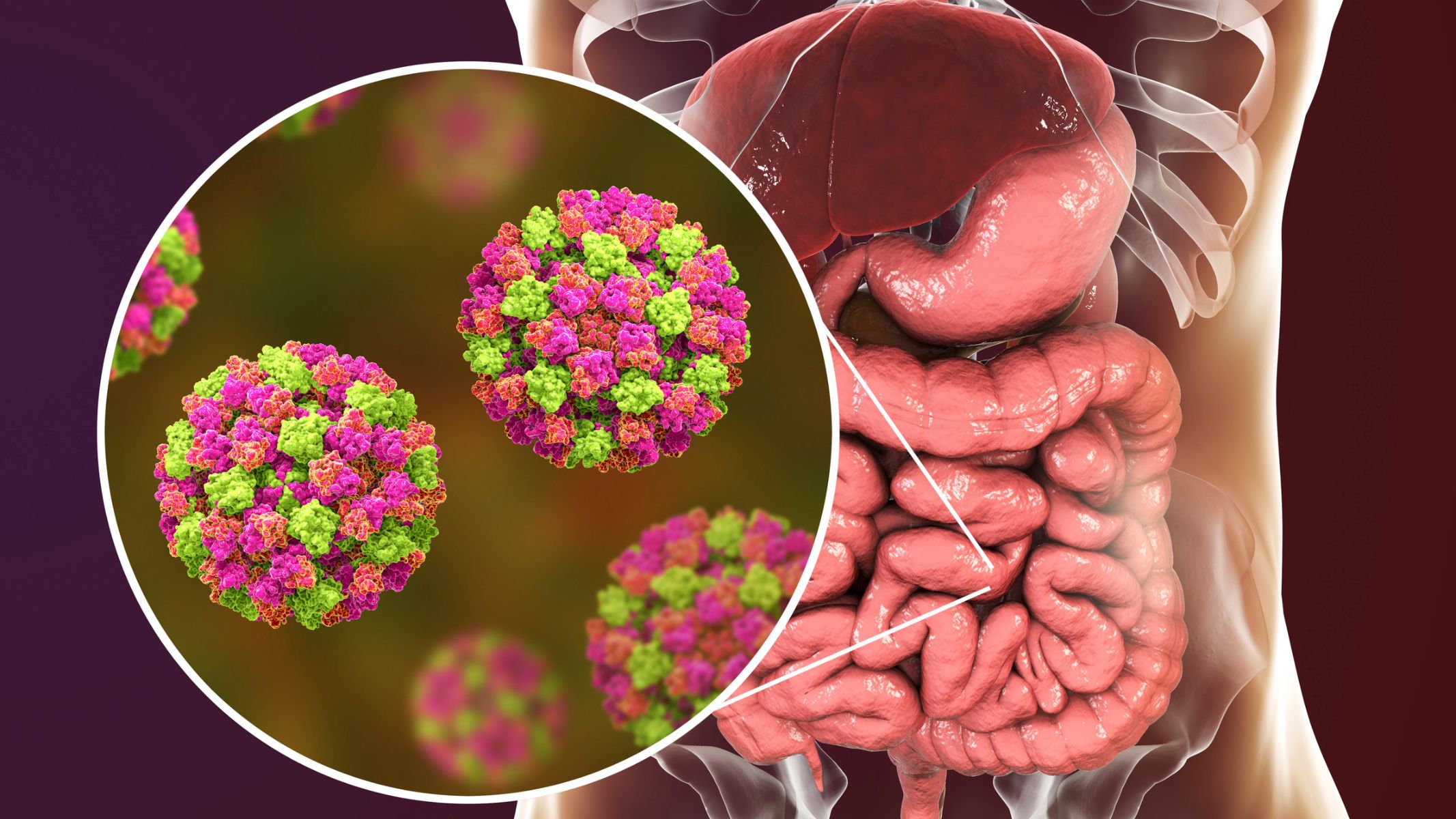 Viêm dạ dày ruột có nguy hiểm không?