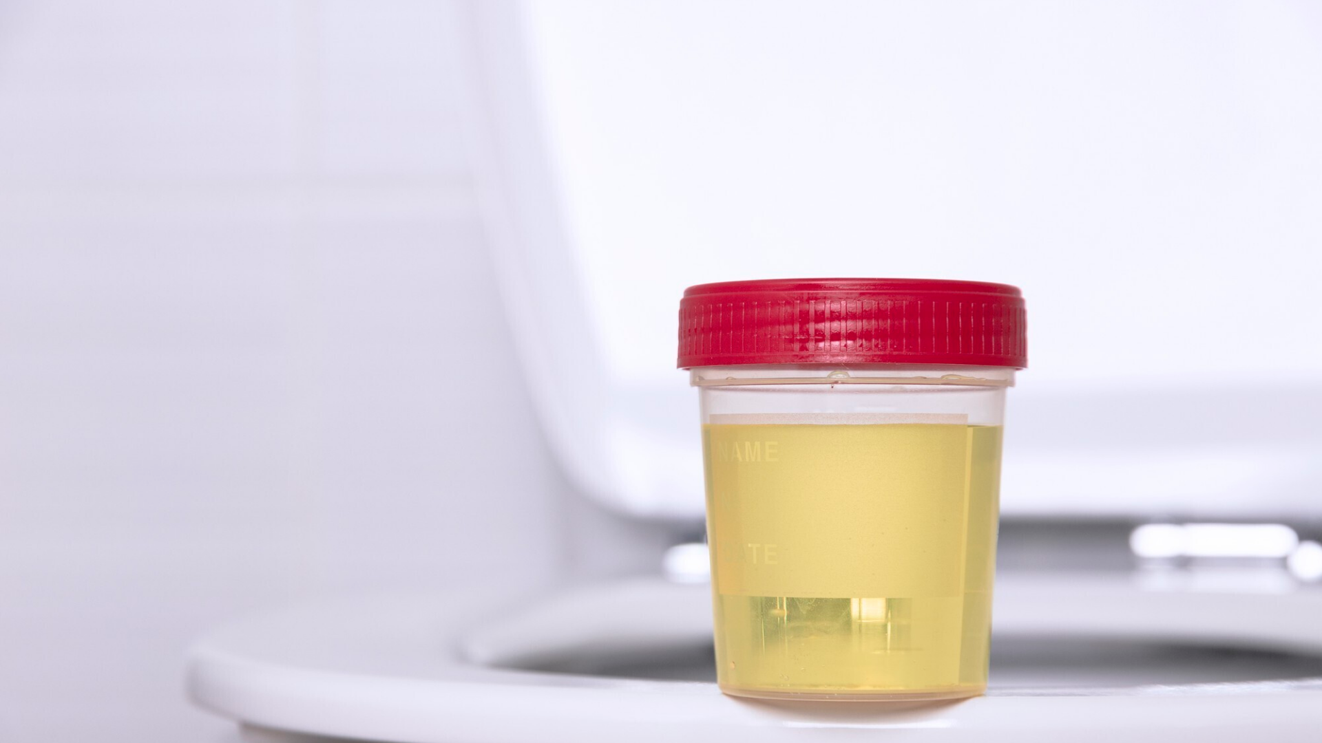 Nước tiểu trong trở lại, không còn mùi hôi bất thường