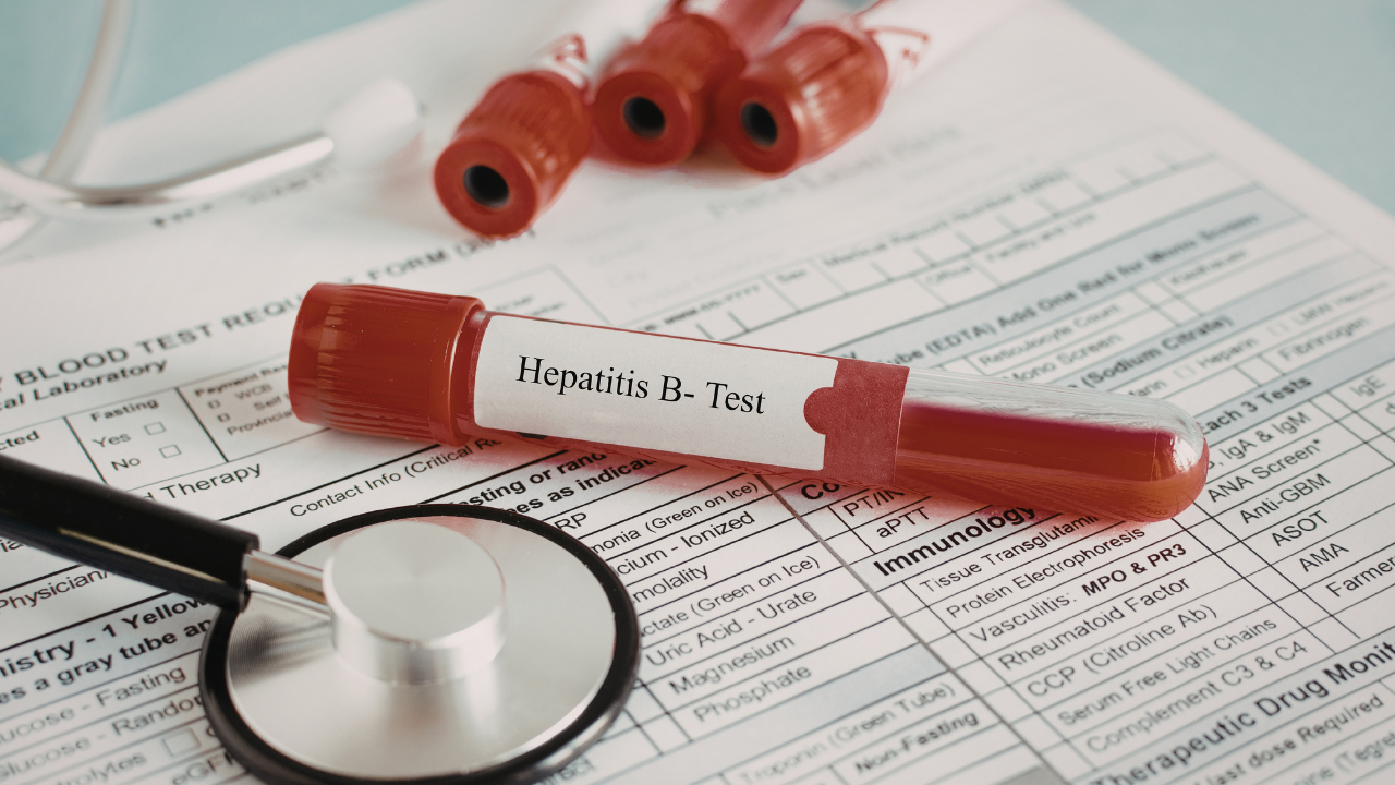 Xét nghiệm chức năng gan như ALT, AST giúp đánh giá mức độ tổn thương gan