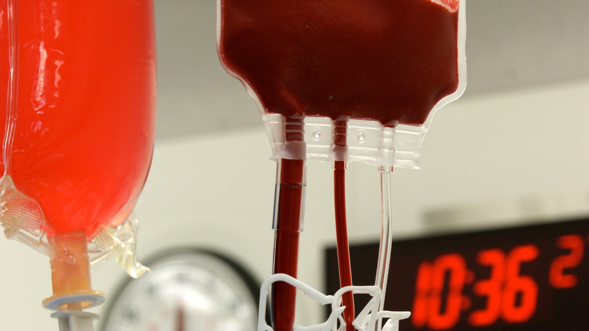 Viêm gan ứ sắt có thể xảy ra ở người phải truyền máu nhiều lần trong thời gian dài