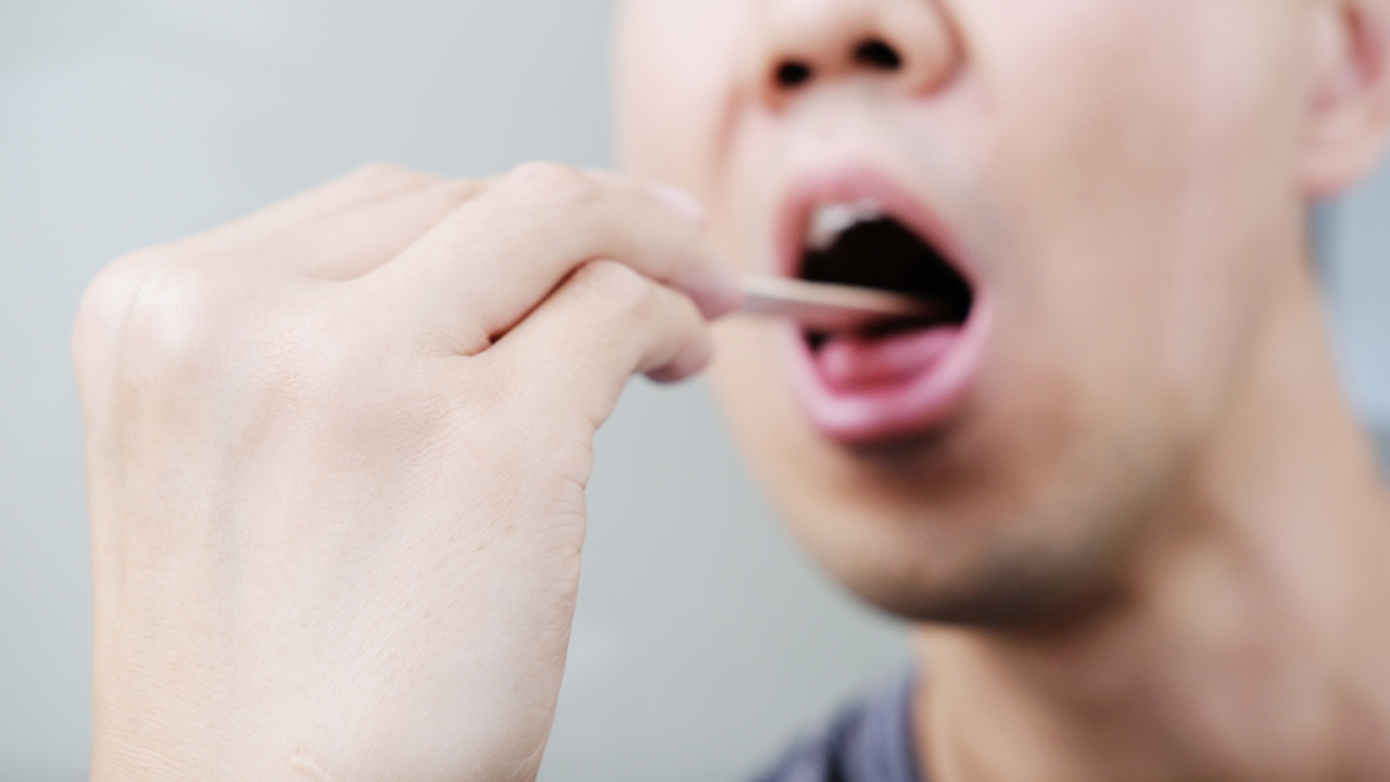 Viêm họng và ung thư vòm họng khác nhau như thế nào? 4