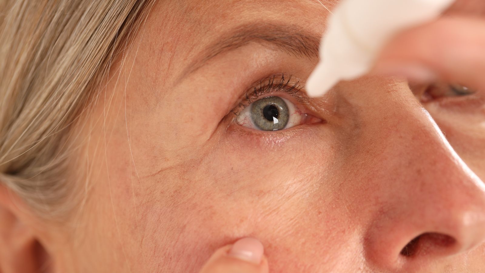 Trong trường hợp viêm do vi khuẩn, bác sĩ thường chỉ định thuốc nhỏ mắt