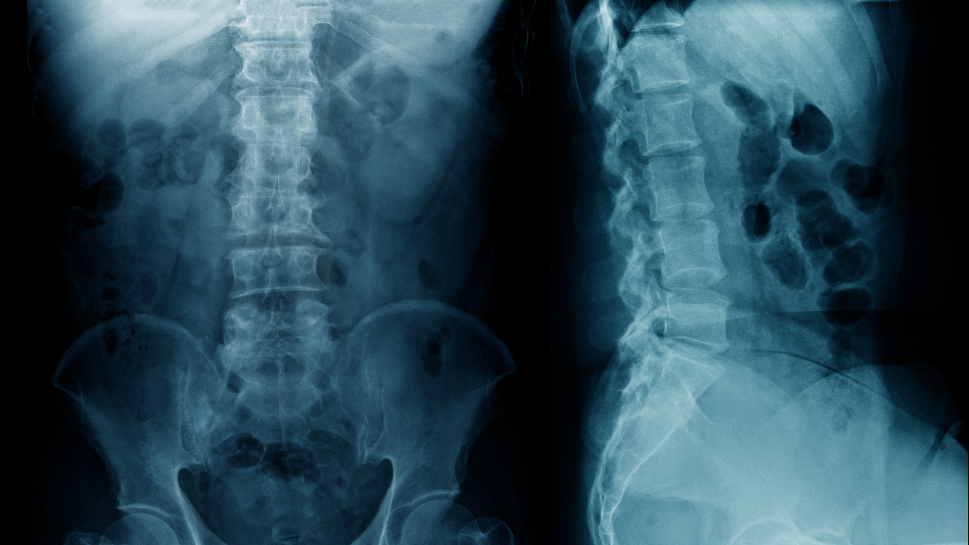 X-quang hỗ trợ quá trình chẩn đoán