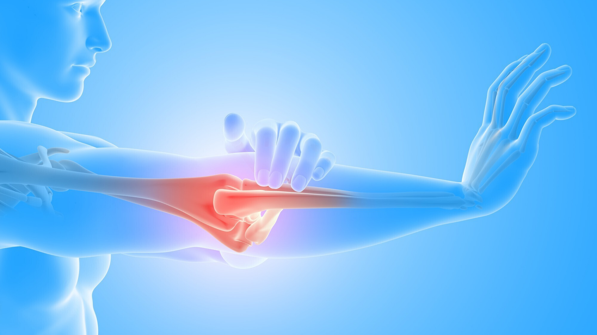 Viêm khớp dạng thấp đặc trưng bởi tình trạng hệ miễn dịch tấn công nhầm vào các mô khớp, gây viêm, sưng và đau khớp