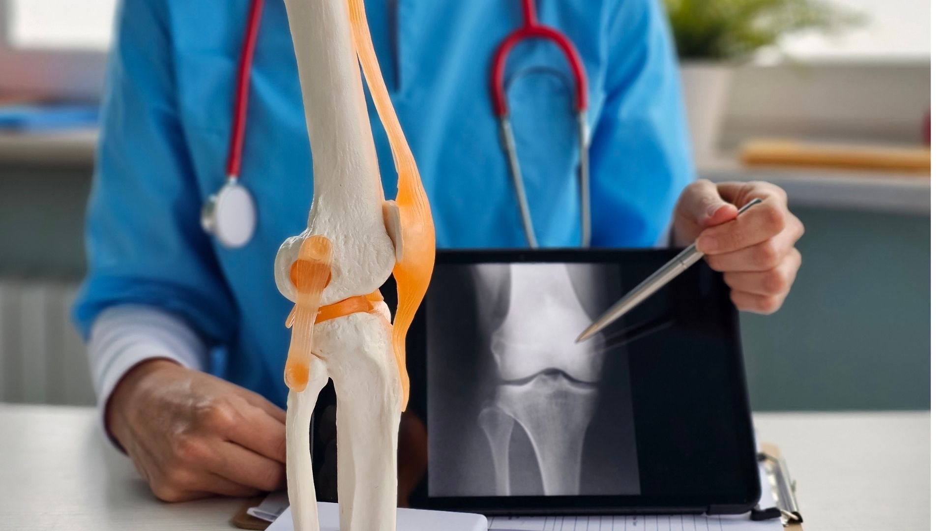 Viêm khớp gối lâu ngày gây biến dạng khớp