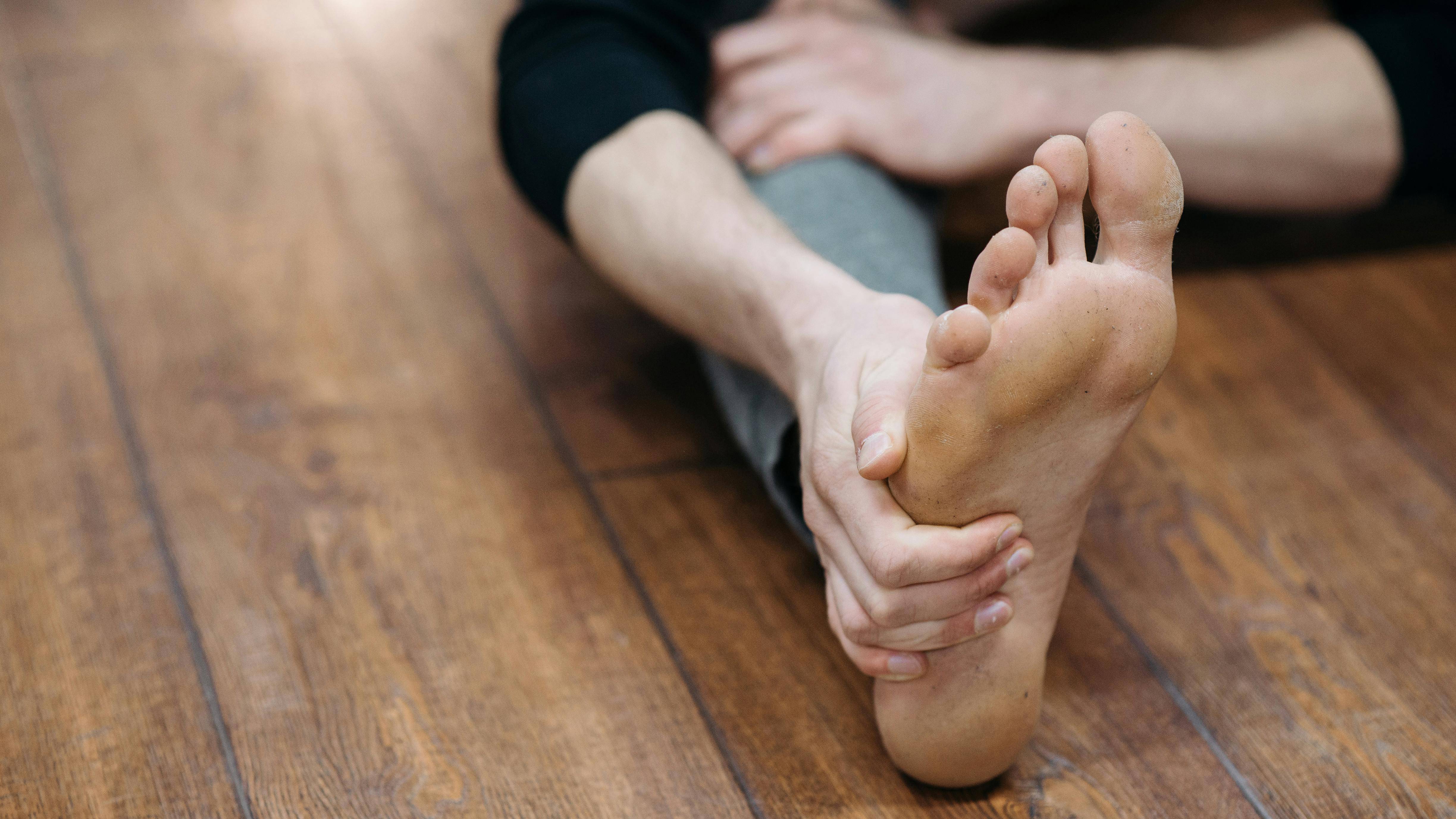 Viêm khớp ngón chân cái là tình trạng viêm khớp MTP - khớp nối ngón chân cái với bàn chân