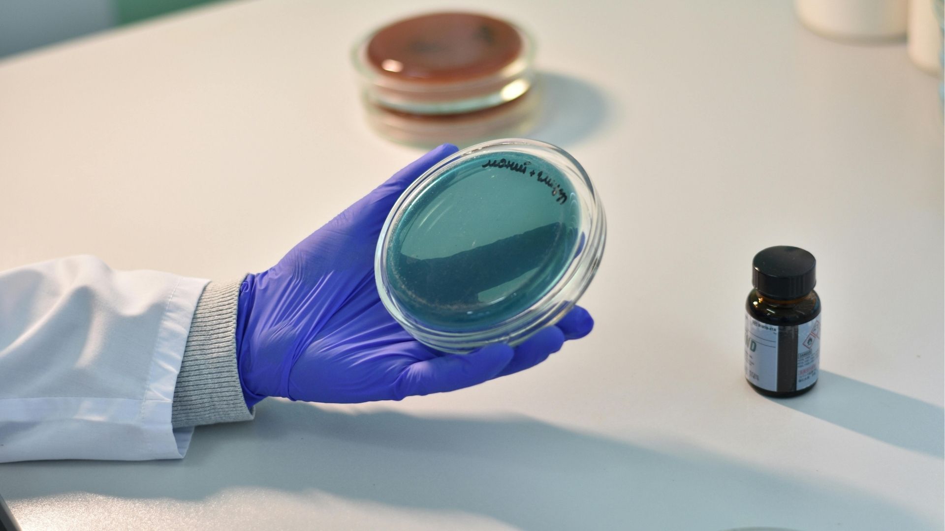 Viêm khớp ức đòn khiến nhiễm trùng lan rộng