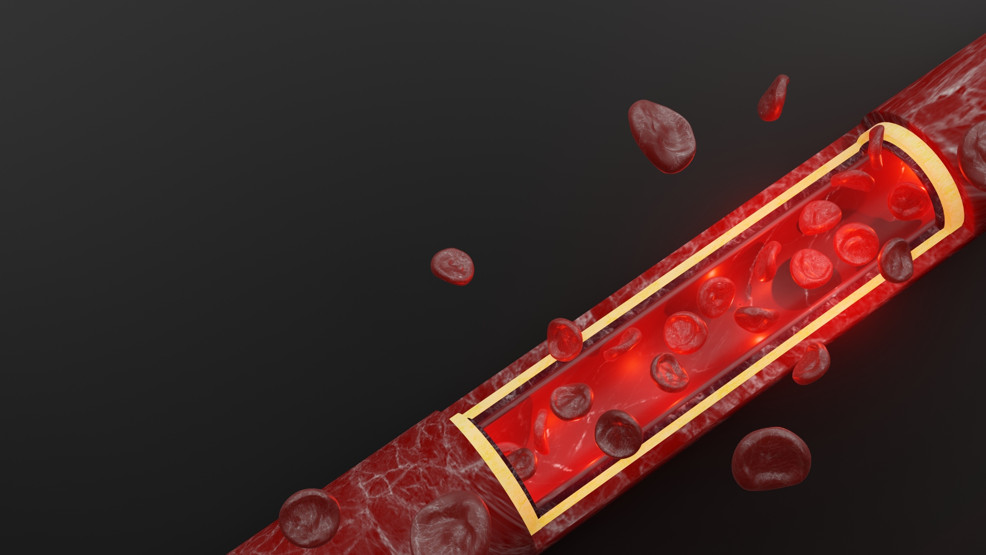 Viêm mạch máu có thể ảnh hưởng đến nhiều cơ quan, tiến triển âm thầm theo từng giai đoạn và gây niến chứng nặng nề