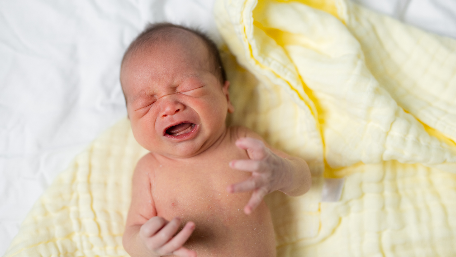 Dấu hiệu viêm màng não mủ ở trẻ sơ sinh sớm bao gồm quấy khóc kéo dài không rõ nguyên nhân