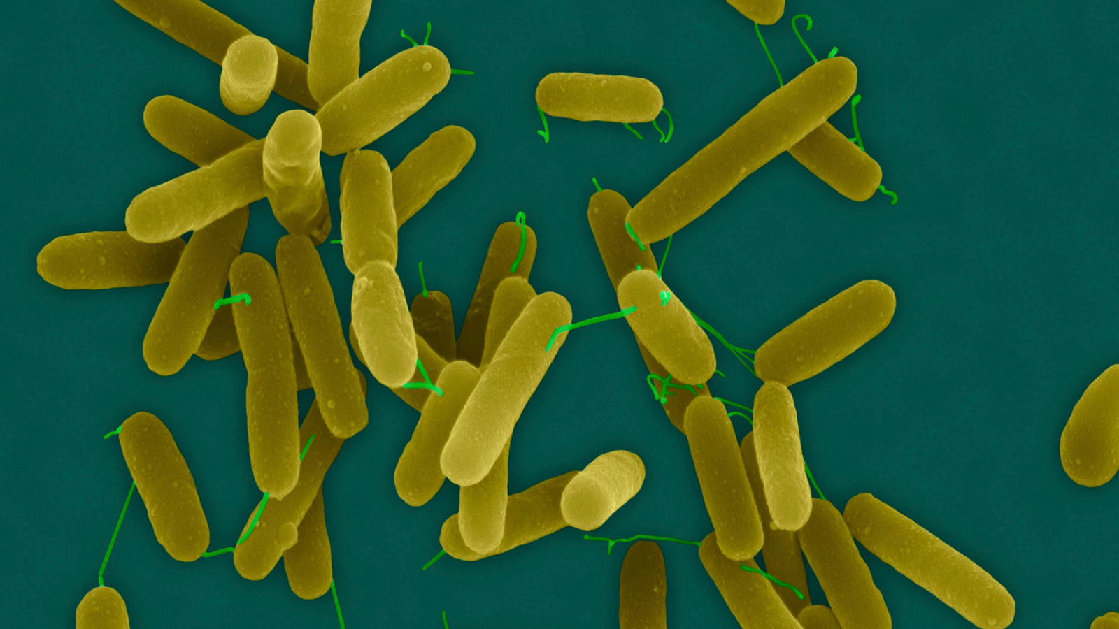 Vi khuẩn tụ cầu hoặc pseudomonas (thường có trong hồ bơi, bồn tắm nước nóng) là tác nhân phổ biến