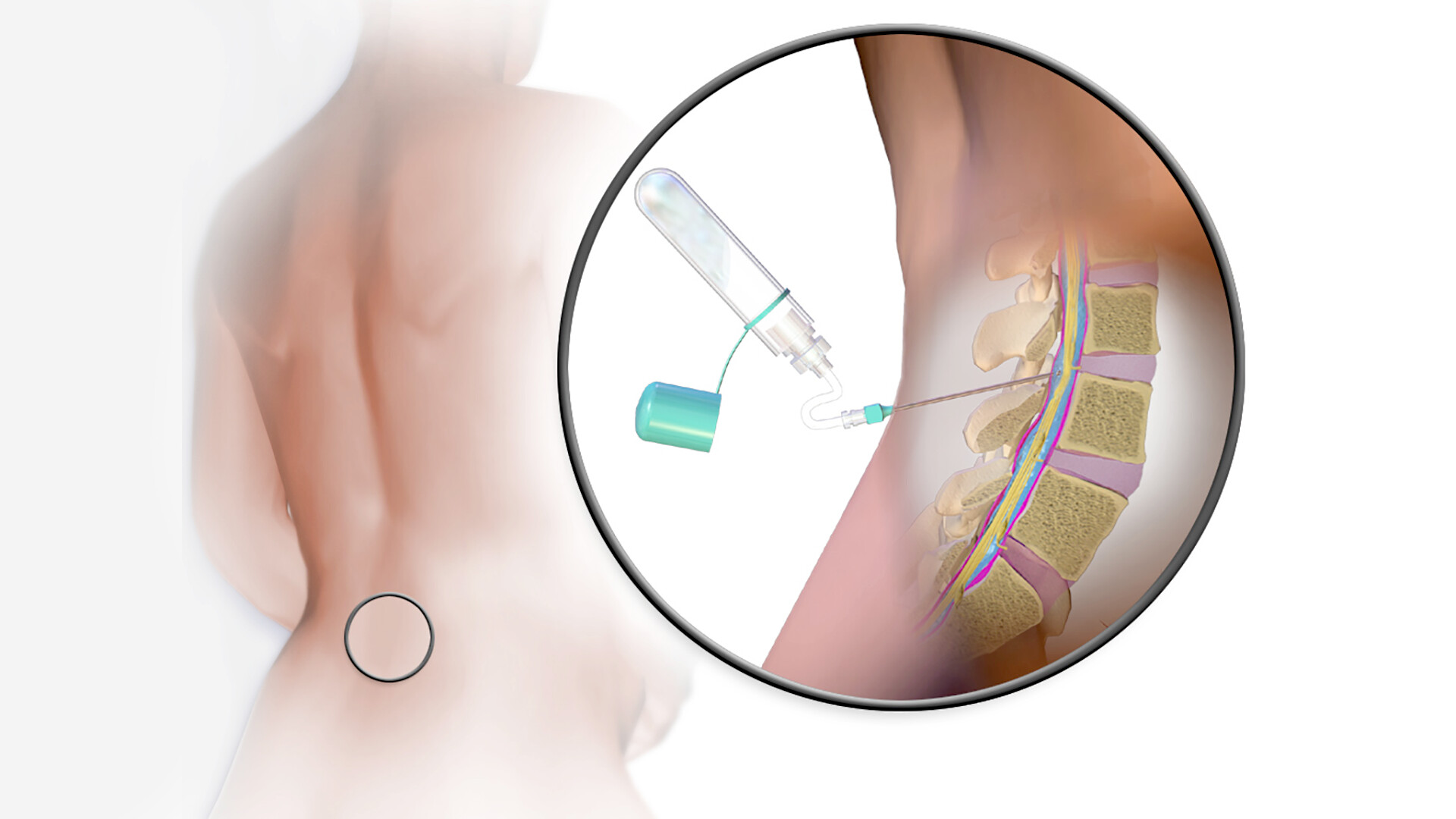 xét nghiệm cận lâm sàng đóng vai trò quan trọng