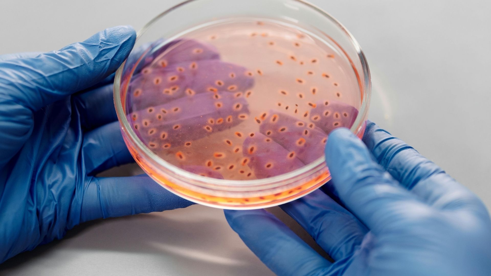 Vi khuẩn Helicobacter pylori là nguyên nhân phổ biến gây bệnh