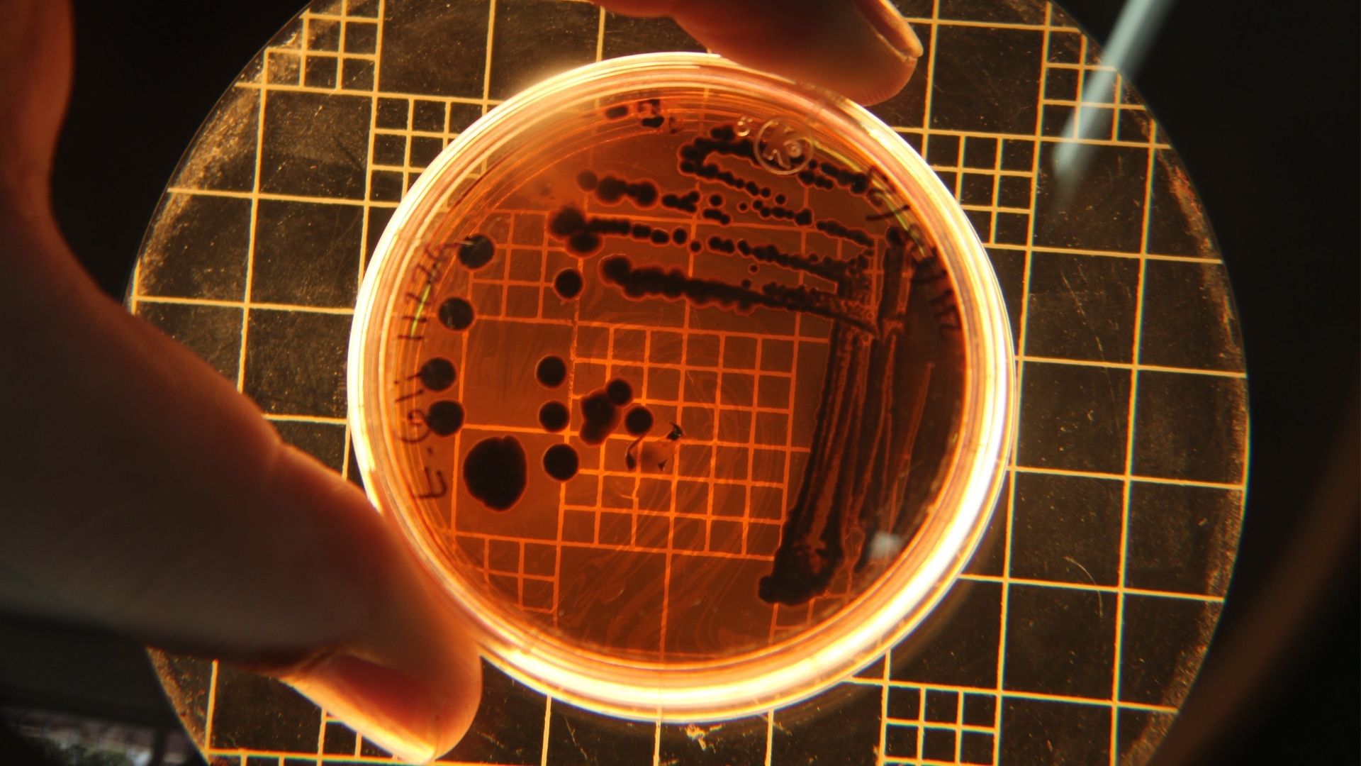 Người từng nhiễm Helicobacter pylori có thể bị tái phát bệnh