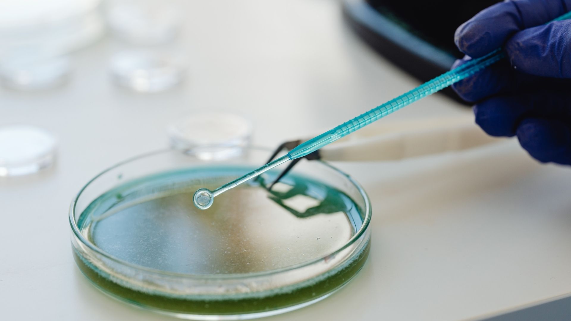 Viêm thực quản có thể do vi khuẩn cơ hội gây nên