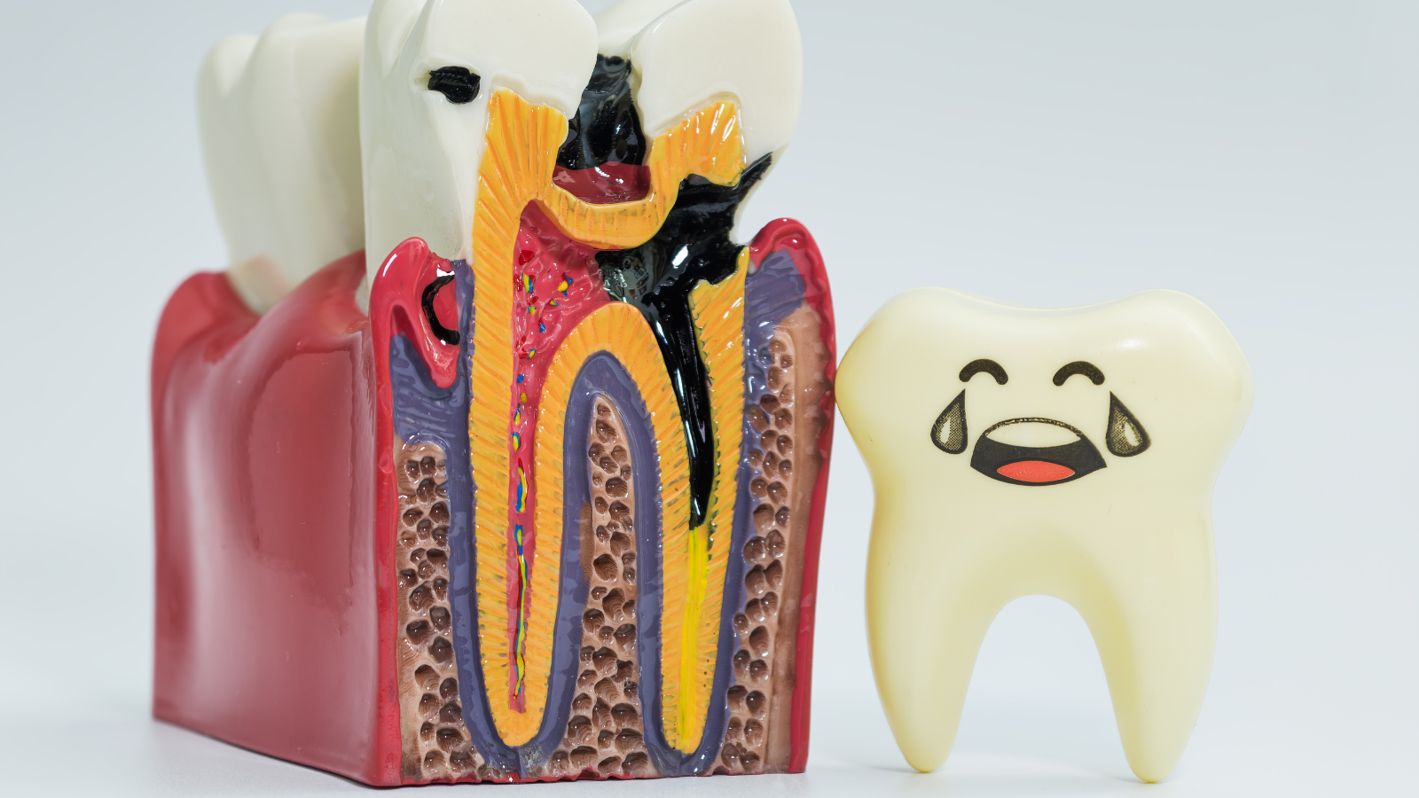 Mối liên hệ giữa chế độ ăn uống và viêm tủy răng