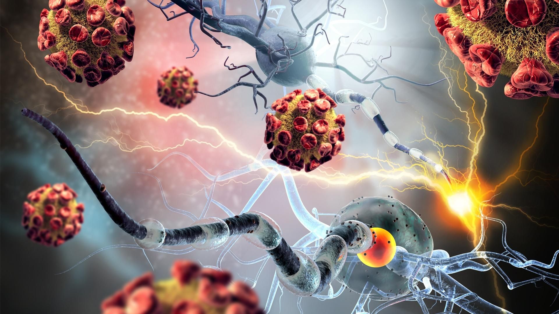 Nguyên nhân chính của bệnh viêm tuyến giáp hashimoto là rối loạn tự miễn trong cơ thể