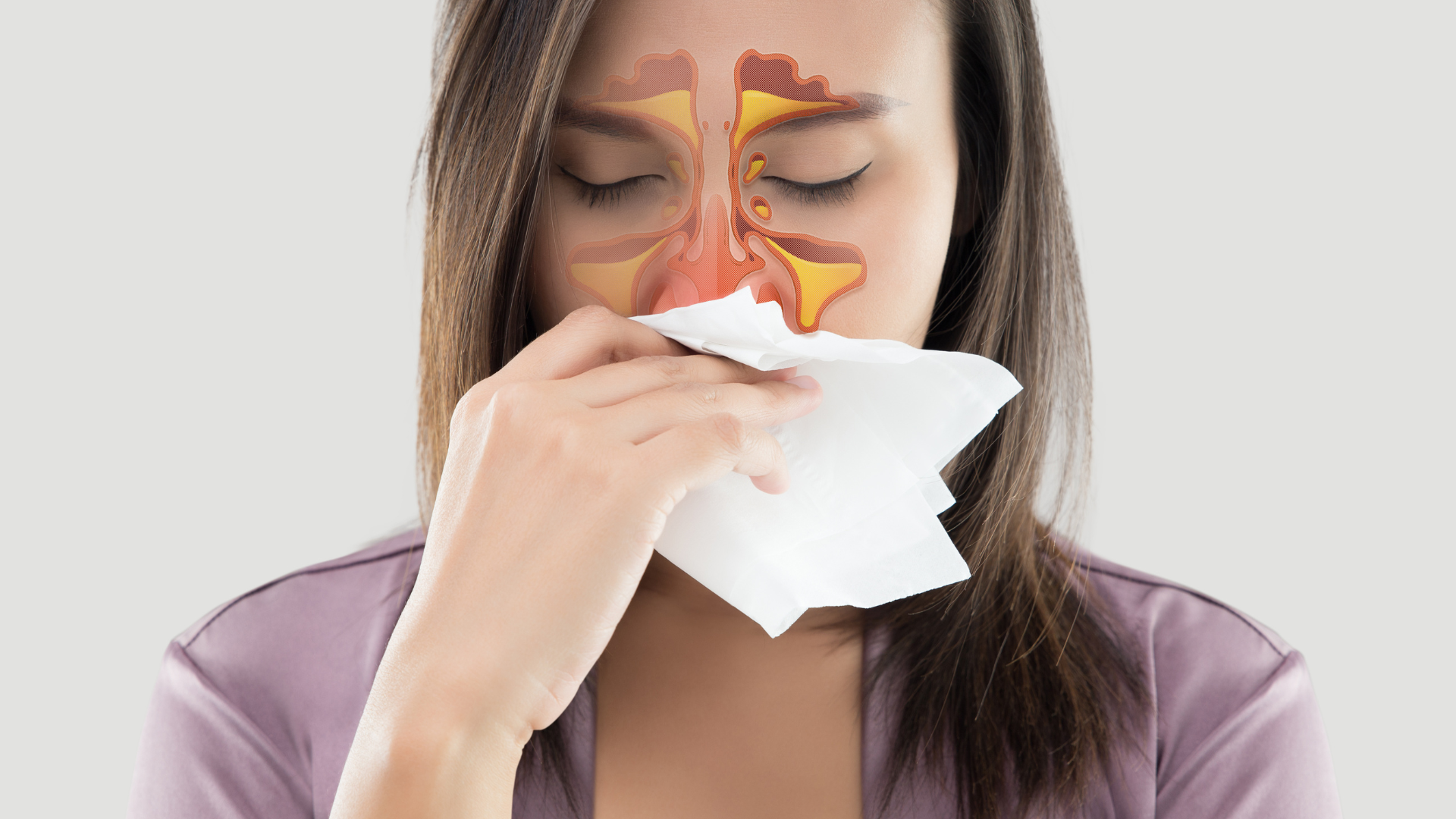 Viêm xoang chảy máu mũi là gì? Nguyên nhân và phương pháp điều trị phổ biến 3