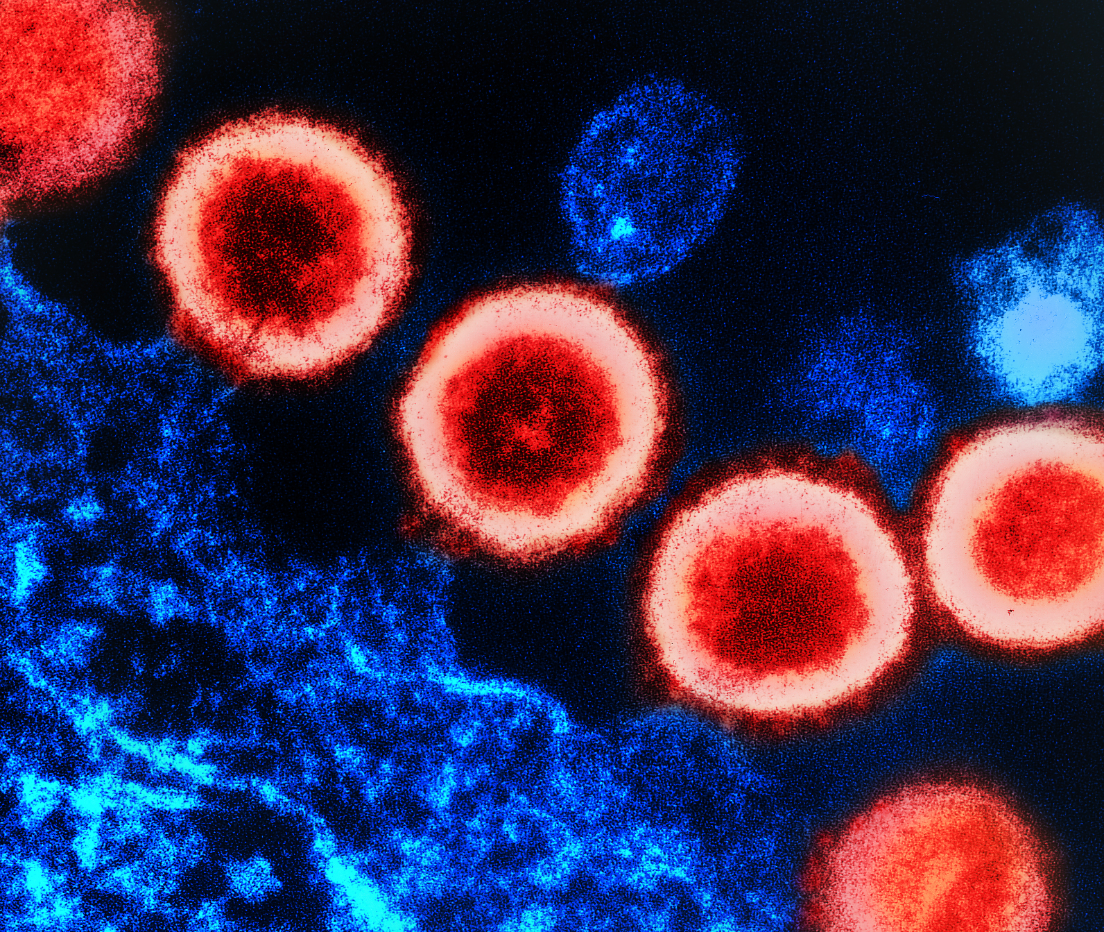 Virus HIV là gì? Cách virus HIV xâm nhập vào cơ thể gây bệnh 2