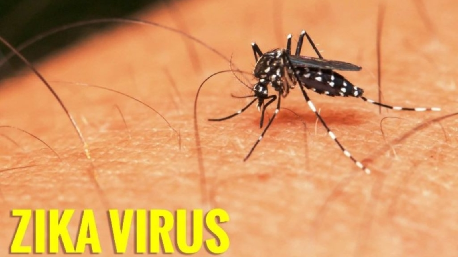 Virus zika gây teo não tác động đến quá trình hình thành và phát triển hệ thần kinh trung ương của thai nhi