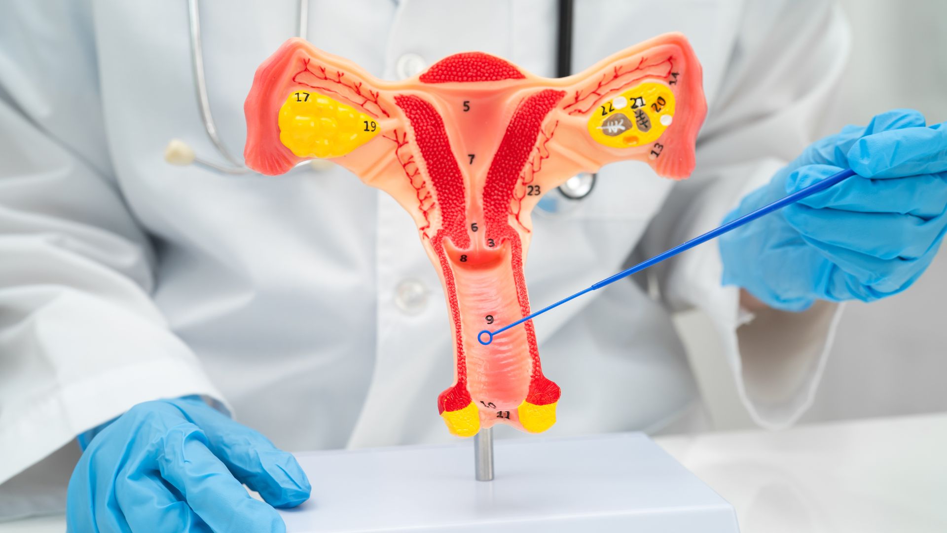 Nhiễm trùng âm đạo là một trong các nguyên nhân gây vỡ ối