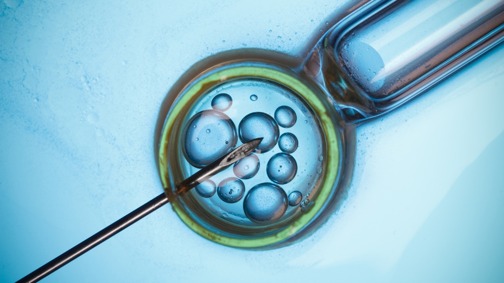 IVF là một kỹ thuật hỗ trợ sinh sản hiện đại, hiệu quả trong điều trị vô sinh hiếm muộn